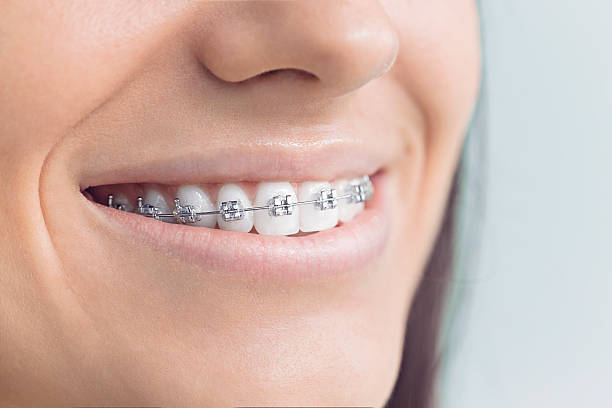 Best Traditional Braces  in Weidman, MI